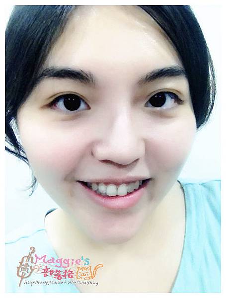 佳醫美人診所 (40).JPG