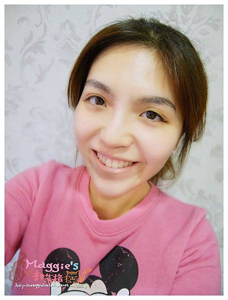 美麗爾縫雙眼皮 (11).JPG 美麗爾縫雙眼皮 (11).JPG