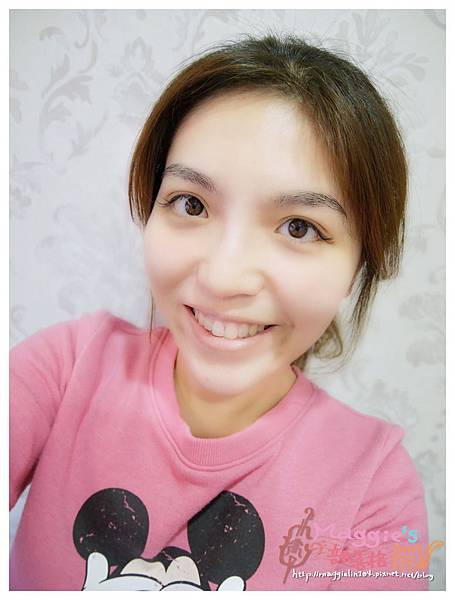 美麗爾縫雙眼皮 (12).JPG 美麗爾縫雙眼皮 (12).JPG