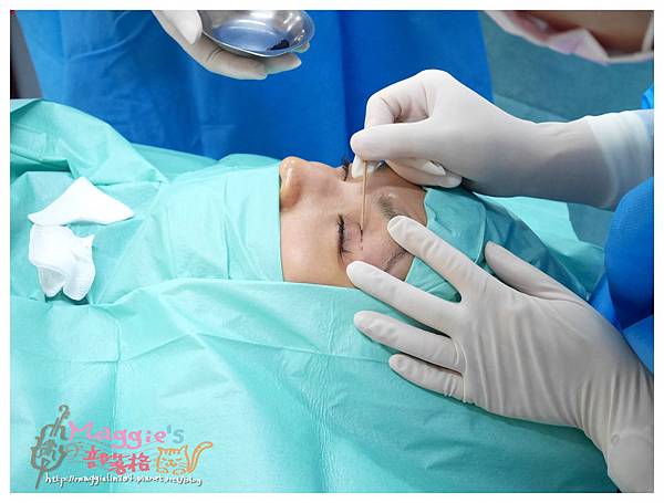 美麗爾縫雙眼皮 (24).JPG 美麗爾縫雙眼皮 (24).JPG