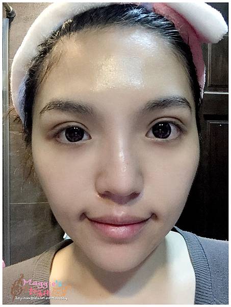 美麗爾縫雙眼皮 (36)