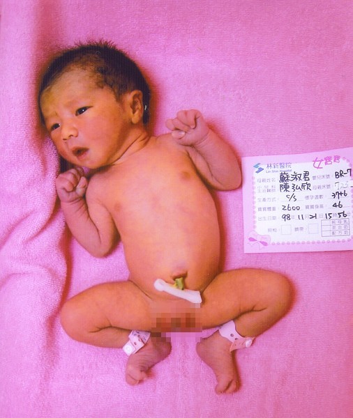 這是醫院寄來的照片~小瑪洗了生平第一次澡澡後拍下的照片