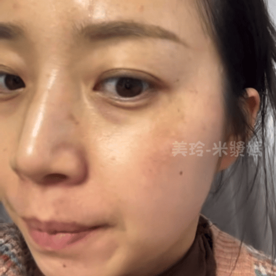敏感肌灌膚保養步驟