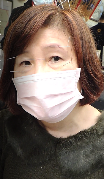 巴金森 溫崇凱中醫師針灸.png