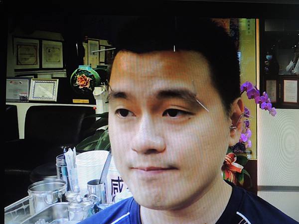 胃食道逆流針灸 溫崇凱中醫師.jpg