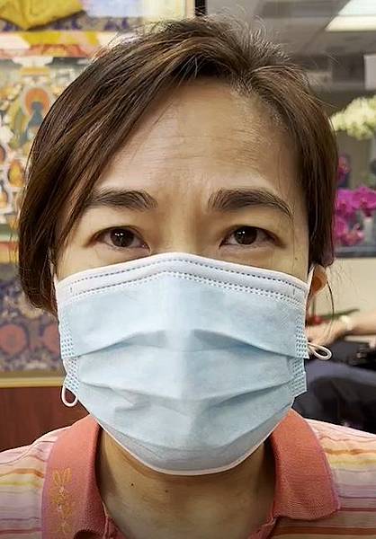 皮膚癢 溫崇凱中醫針灸.jpg