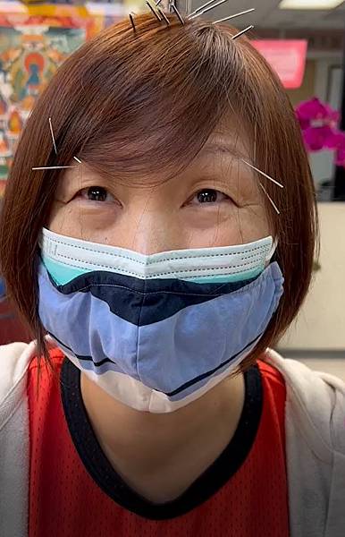 頭暈 溫崇凱中醫師針灸.jpg