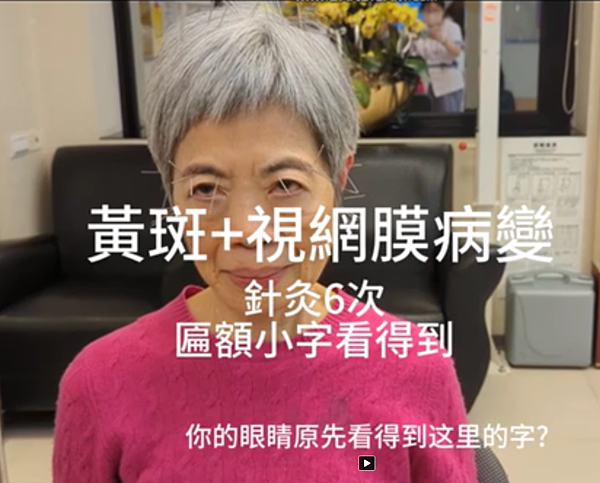 黃斑病變+視網膜病變 針灸6次匾額小字看得到
