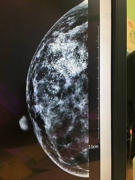 20294130_1962012357376600_725894991407249093_n 20294130_1962012357376600_725894991407249093_n