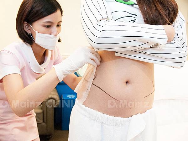 「酷爾塑平CoolSculpting」再進化，一次35分鐘冷凍難瘦的部位 (8).jpg