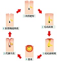 無患子 痘痘 粉刺 去角質11