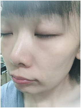 BC百匡,靚顏抗皺淡紋賦活油(百匡賦活膠囊),百匡賦活膠囊,
白龍膽花精萃可亮白撫平細紋與修護受傷肌膚,並高度保濕鎖水,延緩肌膚老化,一顆多種用途,強效版晚安面膜
,百匡賦活膠囊,百匡膠囊
