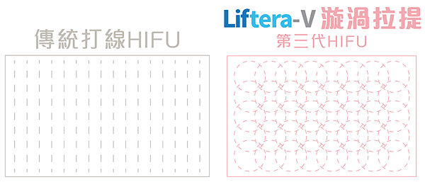 旋渦拉提-Aplus 旋渦拉提-Aplus