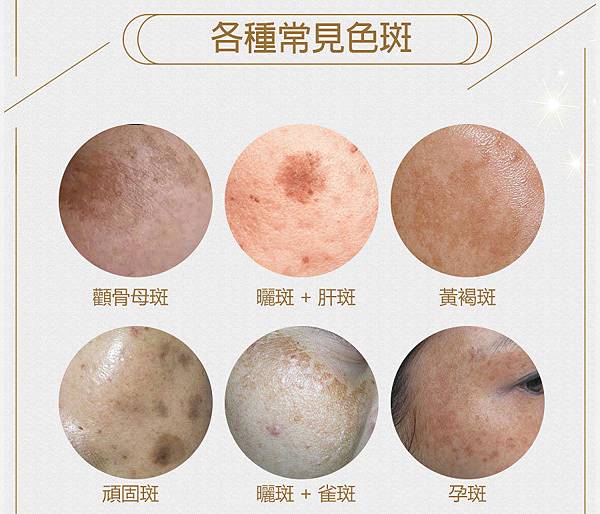 DR.Luo金箔激光美白面膜8.jpg 試用