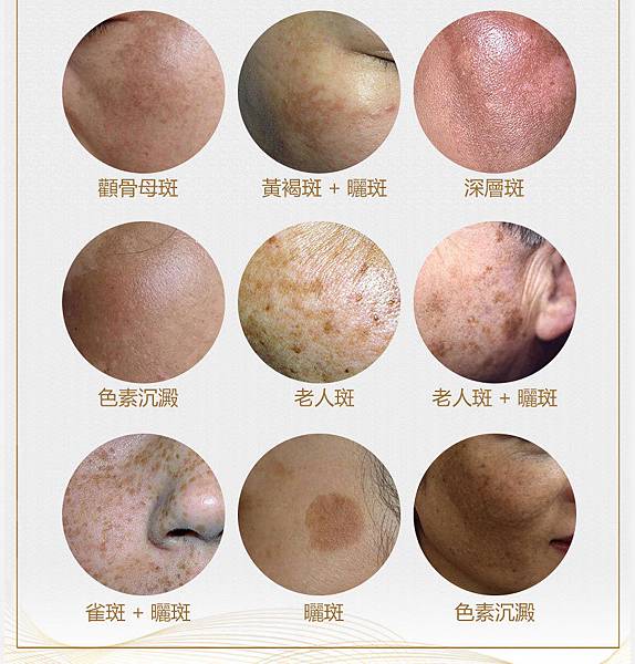 DR.Luo金箔激光美白面膜9.jpg 試用