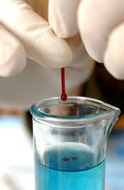 Copper sulfate liquid and blood.jpg