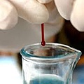 Copper sulfate liquid and blood.jpg