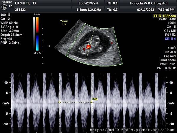 8W4D-2