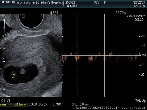 6W6D-2