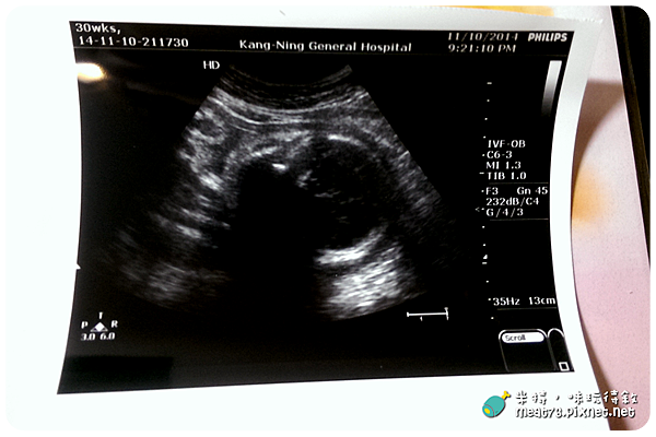 米特，味玩待敘｜部落格 © MEAT76｜台灣美食旅遊部落客｜2014-11-10-1【孕婦產檢紀錄7】30W+1｜康寧醫院｜妊娠性糖尿病報告，抽血驗B肝(健保給付)001.png