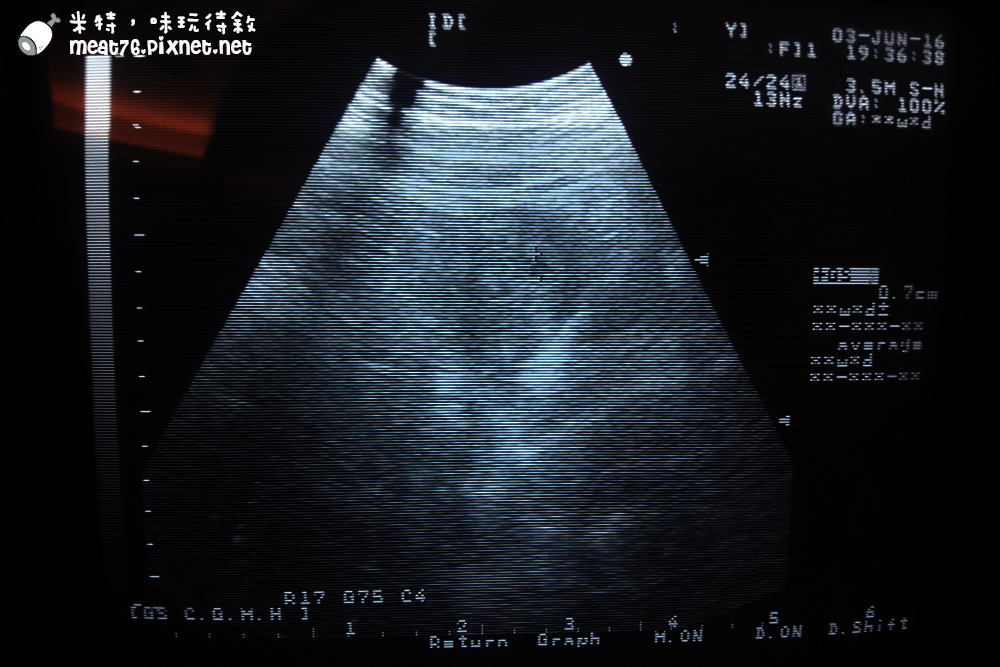 米特味玩待敘台灣美食親子部落客©MEAT76｜2016-10-29-6【懷孕｜二寶樂樂】米特晉升二寶媽心情文｜媽呀，我又要當媽了！懷二寶心中真的滿滿五味雜陳啊~007.jpg