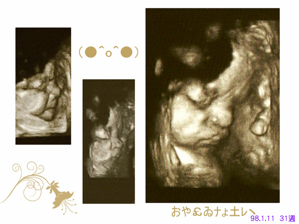 31週-1.jpg 31週-1.jpg