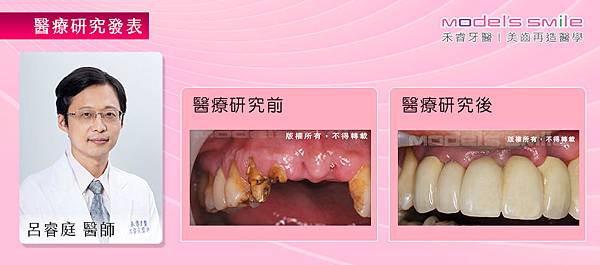 【台北牙醫／即拔即種植牙案例】車禍男斷牙不適 即拔即種還美觀實用前牙