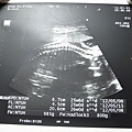 2012-01-31 25週3天,脊椎更完整,體重800~900g了