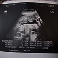 2012-03-16 32週0天,橫隔膜照片,體重1800g