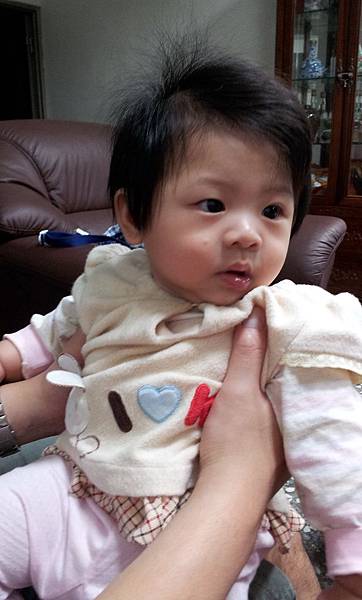 蚊子竟然咬她的臉