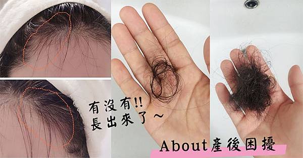 產後掉髮改善吃什麼.jpg 產後掉髮改善吃什麼.jpg