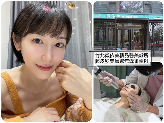 微依美 皮秒雷射9.jpg
