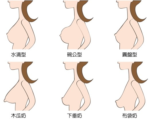 美妍醫美水滴隆乳-各種胸型.jpg 美妍醫美水滴隆乳-各種胸型.jpg