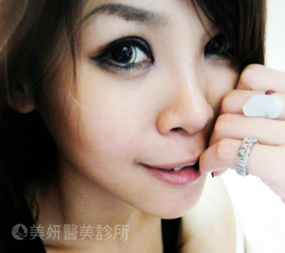 美妍醫美診所-kandy02.png 美妍醫美診所-kandy02.png