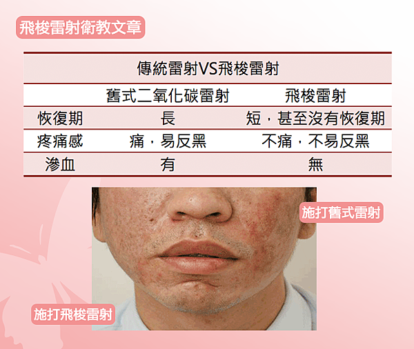美妍醫美-傳統vs飛梭雷射.png 美妍醫美-傳統vs飛梭雷射.png