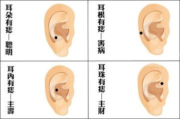 7耳珠有痣