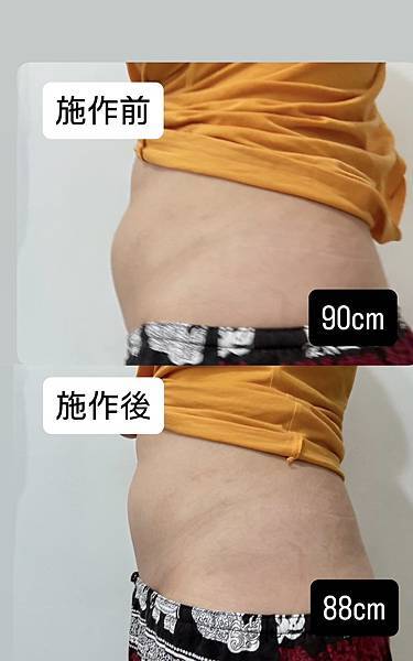 【力美肌塑體驗】台北非侵入式體雕推薦|快速找回線條曲線不是夢