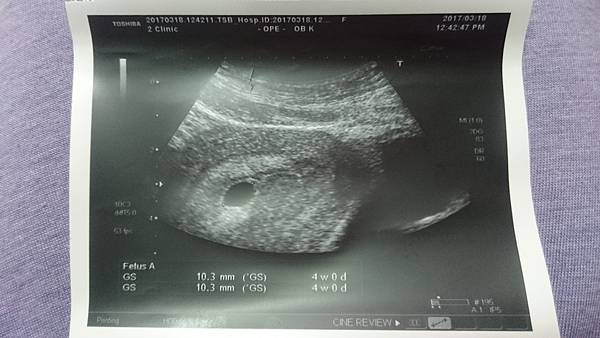 2017-03-18 13.17.08.jpg