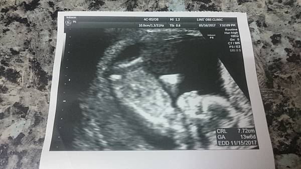 2017-05-16 20.25.32.jpg