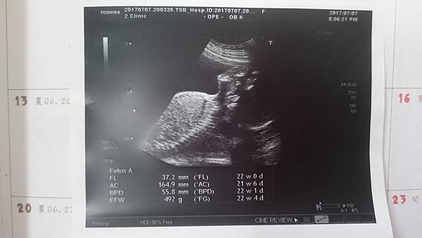 2017-07-08 15.28.08.jpg 2017-07-08 15.28.08.jpg