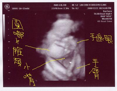 米力32W0D 又遮臉了.jpg