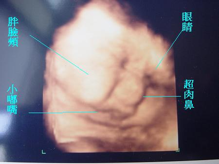 米力38w3d 整個胖啫啫.jpg