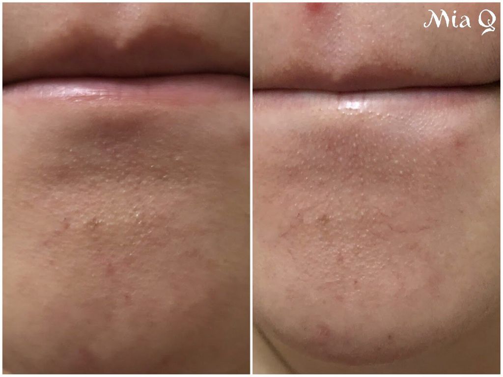 Philosophy微導換膚組 (5).JPG