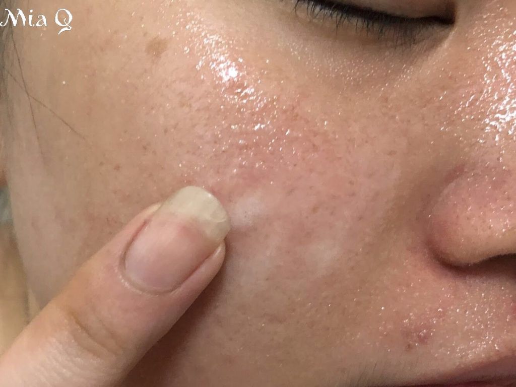 Philosophy微導換膚組 (10).JPG