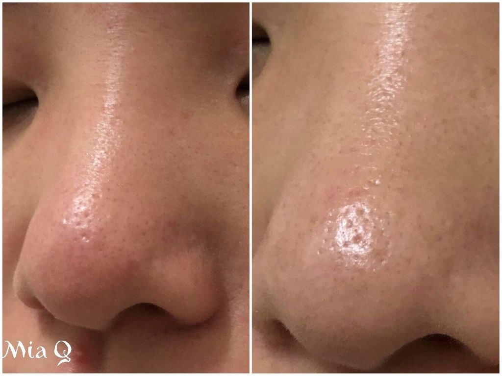 Philosophy微導換膚組 (15).JPG