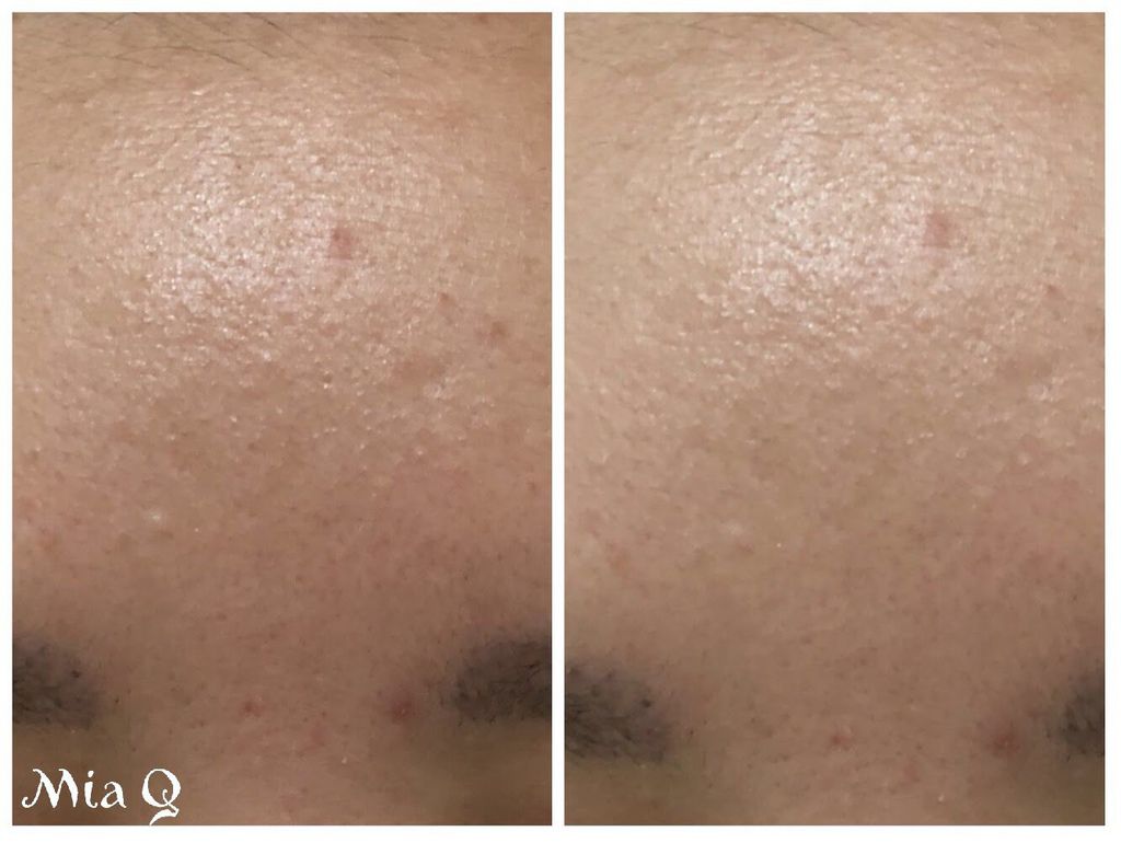 Philosophy微導換膚組 (14).JPG