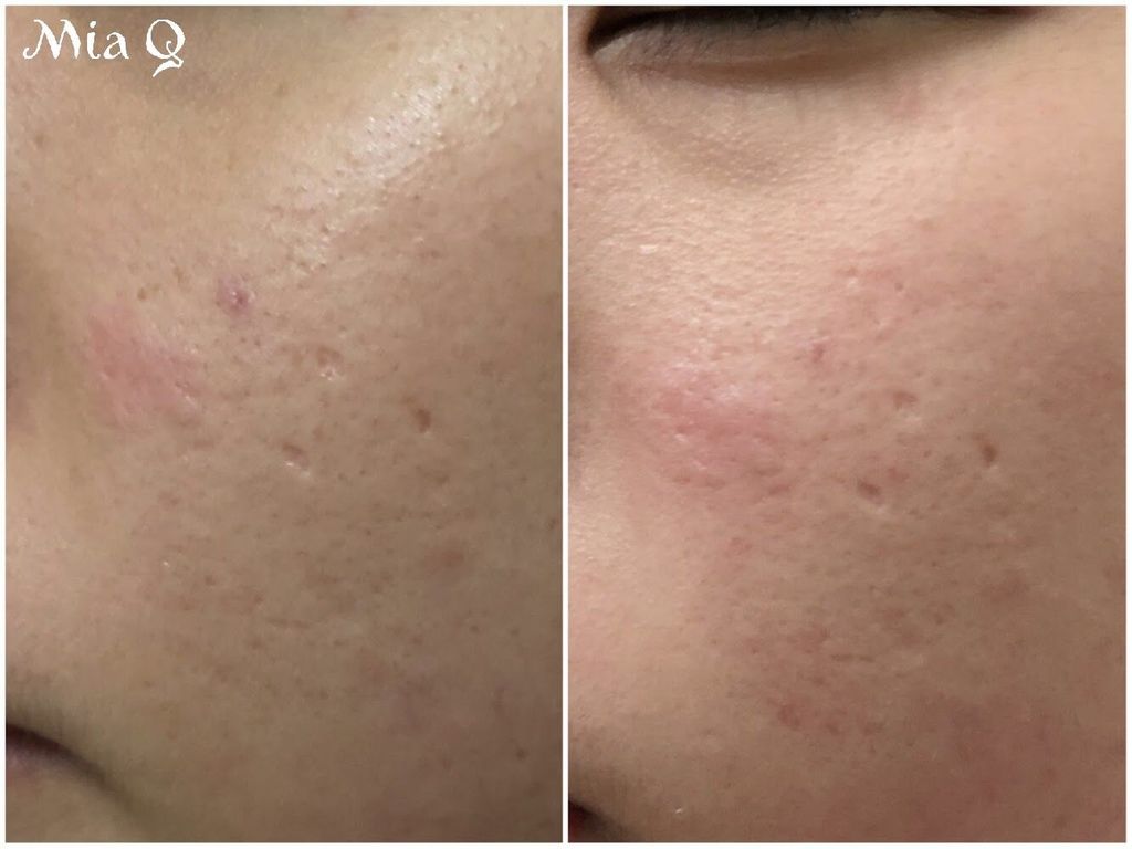 Philosophy微導換膚組 (13).JPG