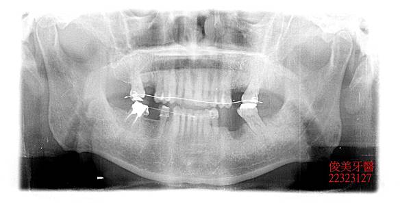 38- (25).JPG 38- (25).JPG