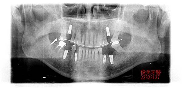 38- (4).JPG 38- (4).JPG