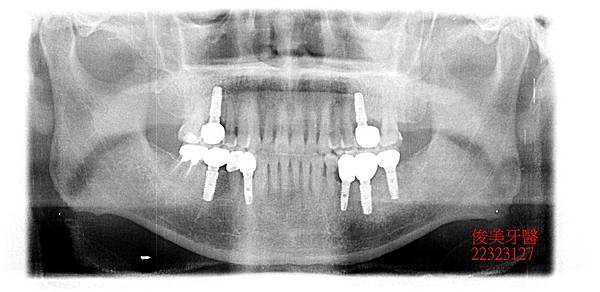 38- (8).JPG 38- (8).JPG